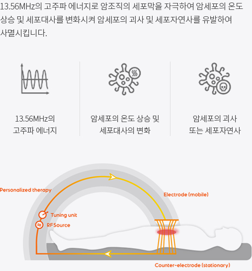 작용원리