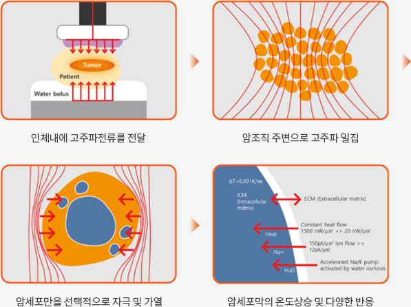 치료 프로세스