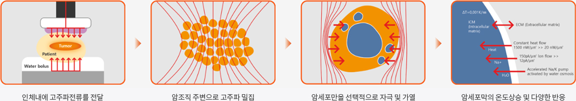 치료 프로세스